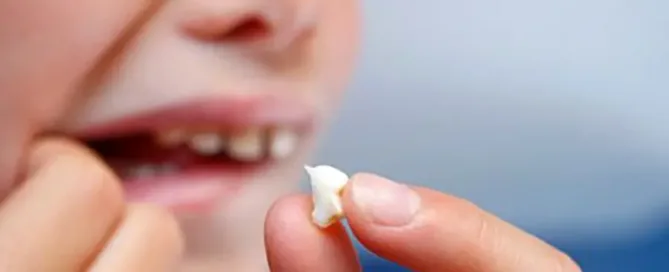 Pokvareni mlecni zub