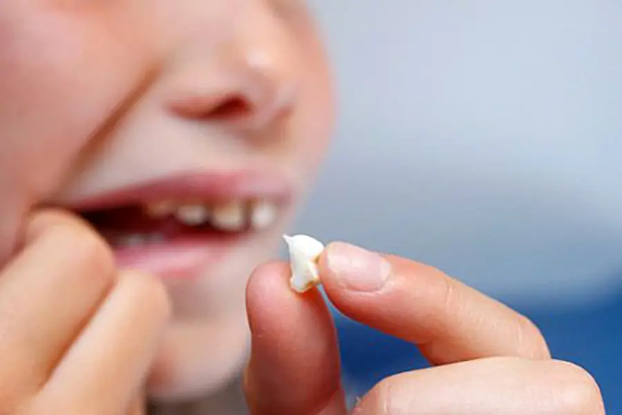 Pokvareni mlecni zub