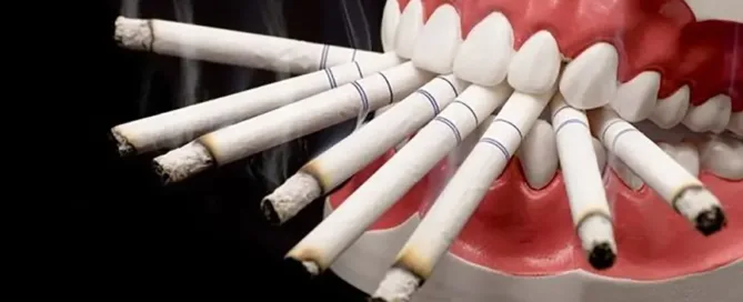 Pusenje i gubitak zuba