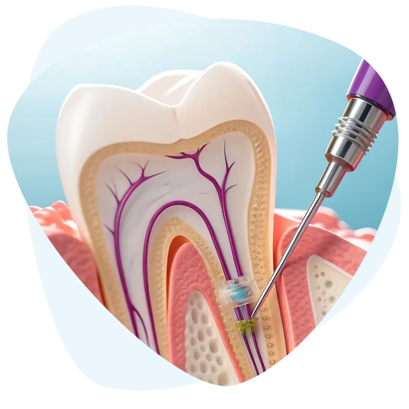 Endodoncija